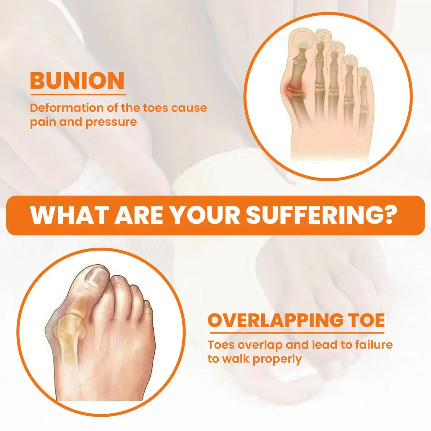 Bunion Straightener